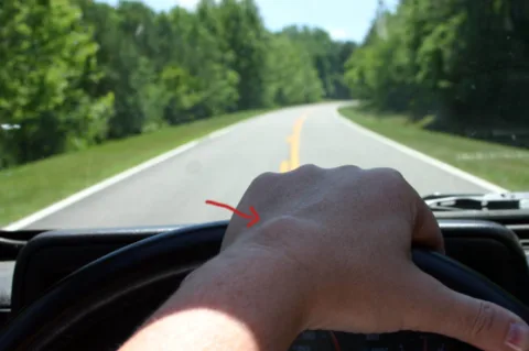 What does a ganglion cyst wrist look like when I'm driving?