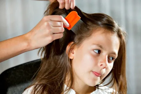 head lice removal isn't a hard process but it does take time